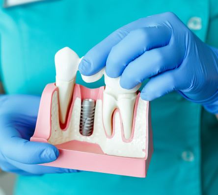 Family Dentistry in Bryant, AR | General Dentistry | Saline Dental